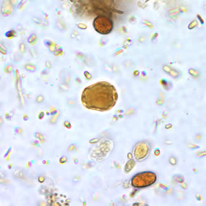 bél paraziták blastocystis hominis)